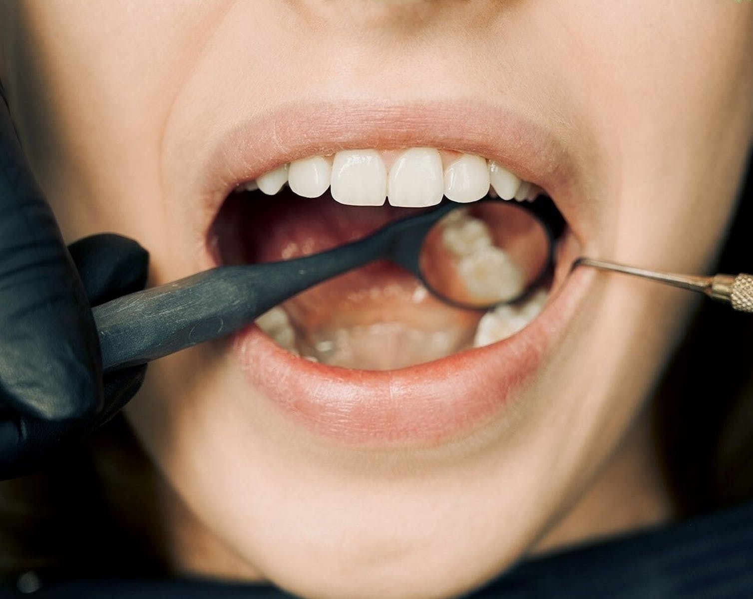 Dental Emergencies: What to Do and When