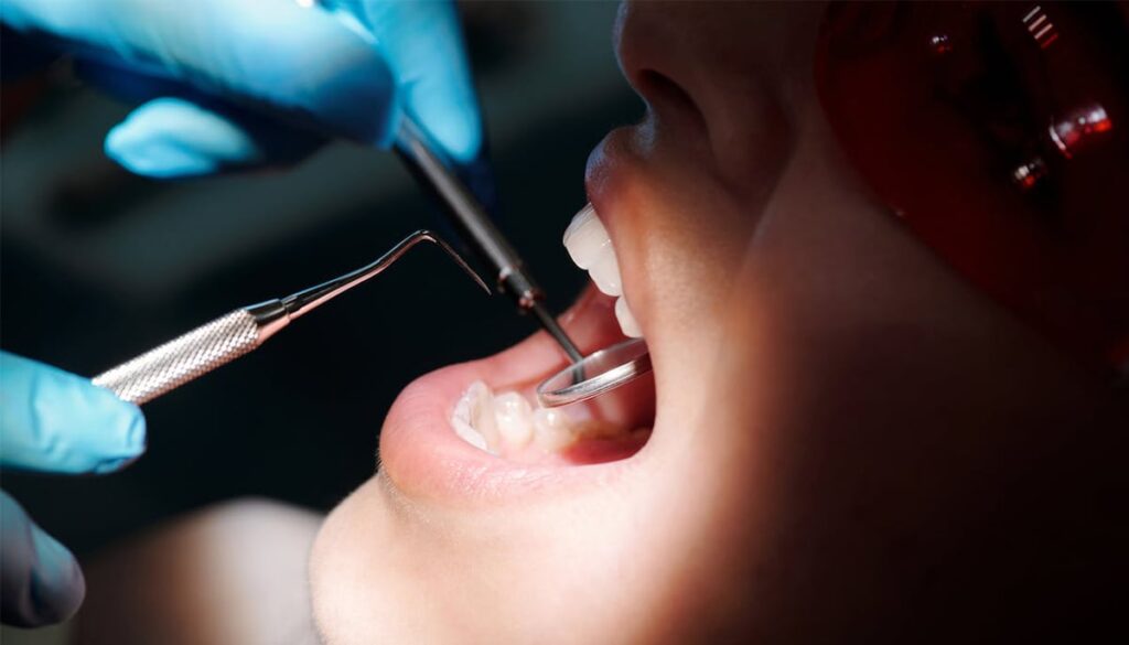 Introduction to Teeth Whitening and Enamel Safety