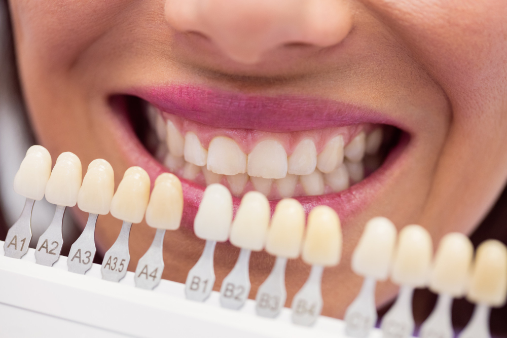 Ozempic Teeth